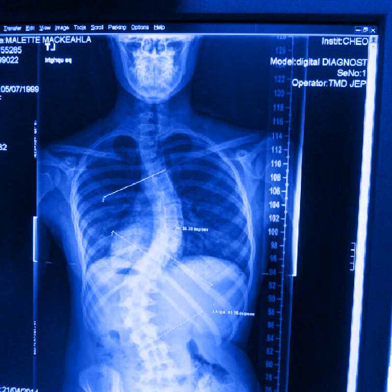 Radiología Digital en RUP
